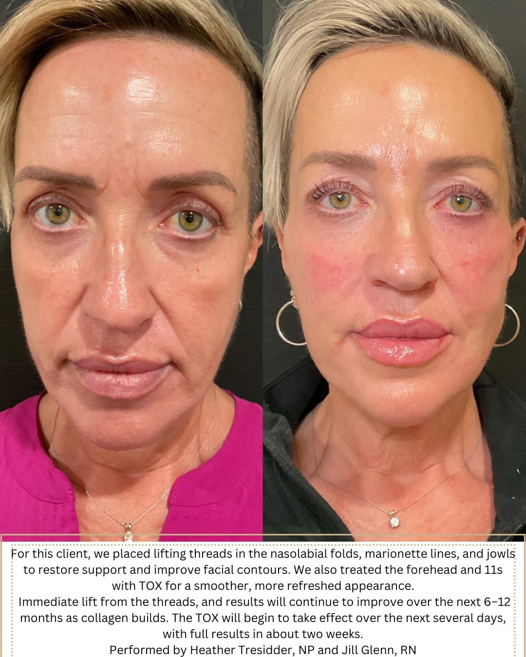 Performed by Heather, NP, and Jill, RN