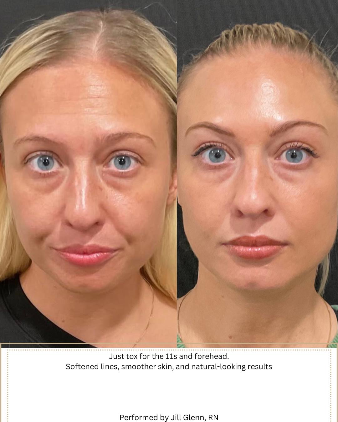 Performed by Jill, Rn