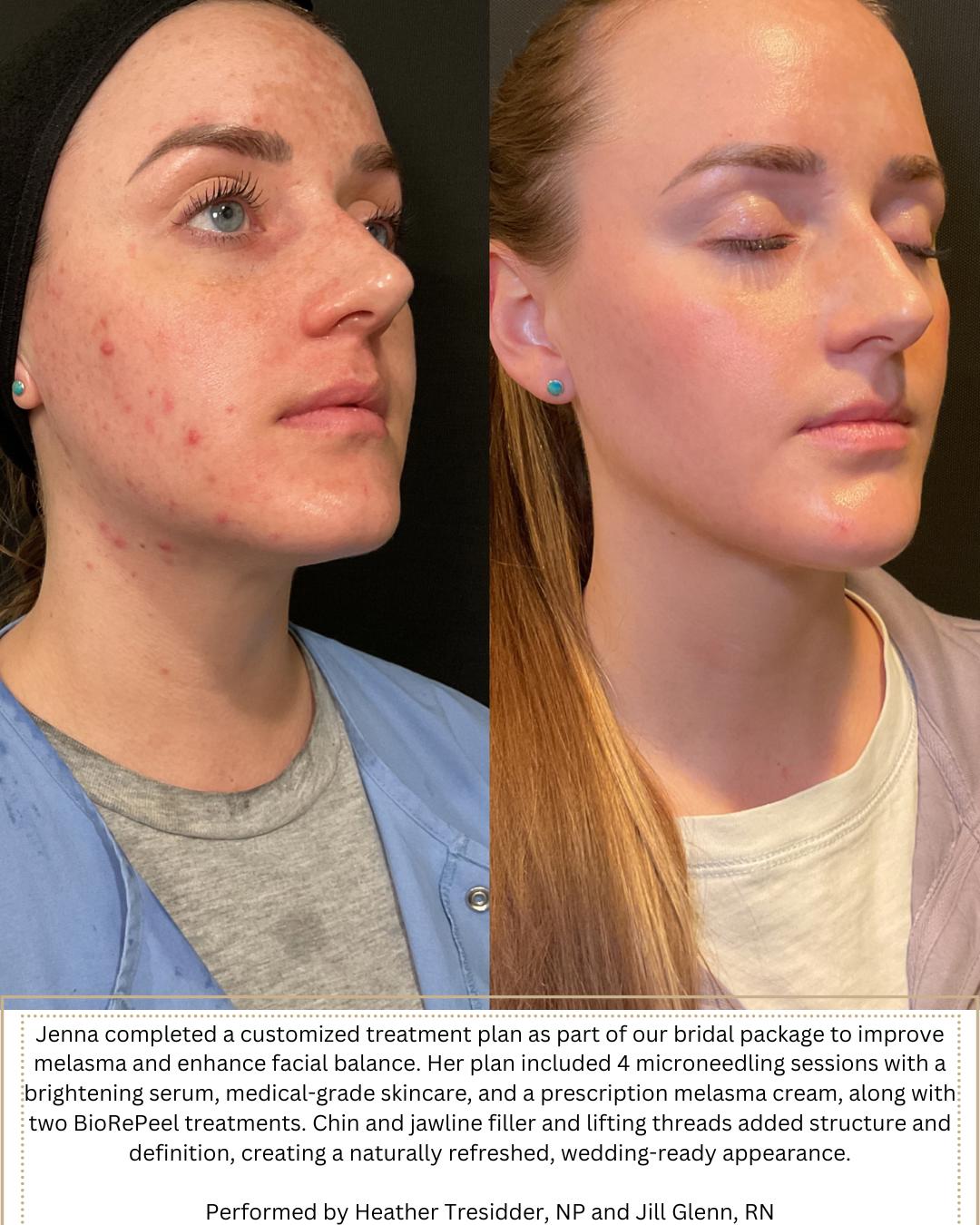 Performed by Heather, NP and Jill, Rn