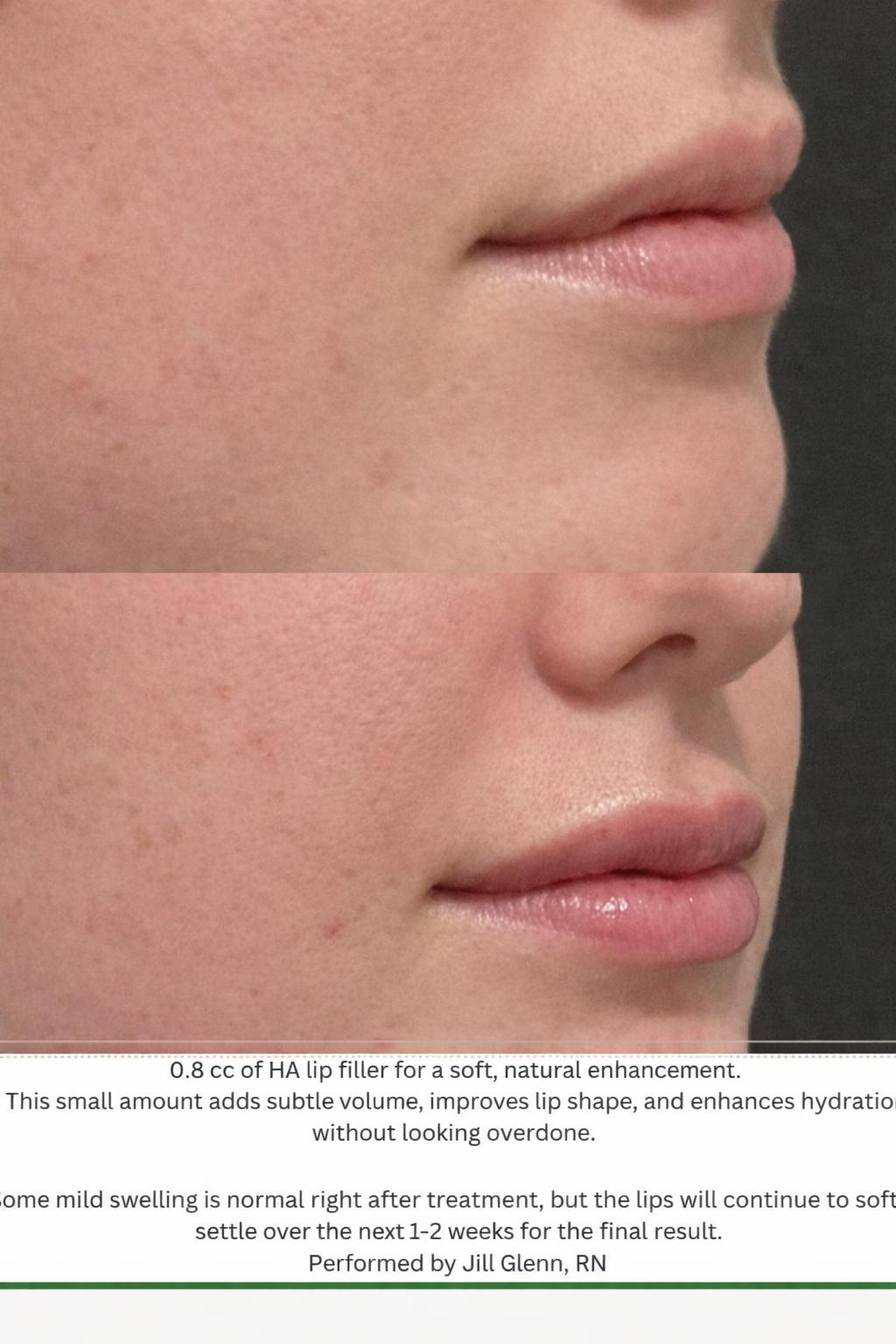 Performed by Jill, Rn