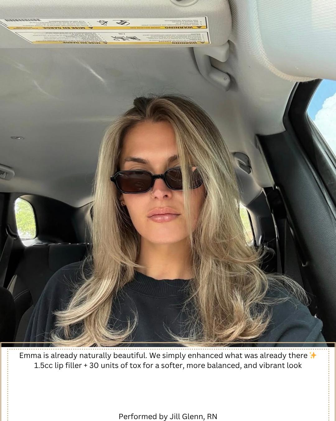 Performed by Heather, NP and Jill, Rn